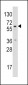 Aromatase (CYP19A1) Antibody (C-term)
